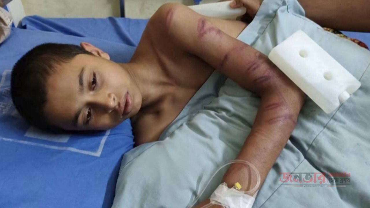 মাদ্রাসা ছাত্রকে অমানবিক নির্যাতন