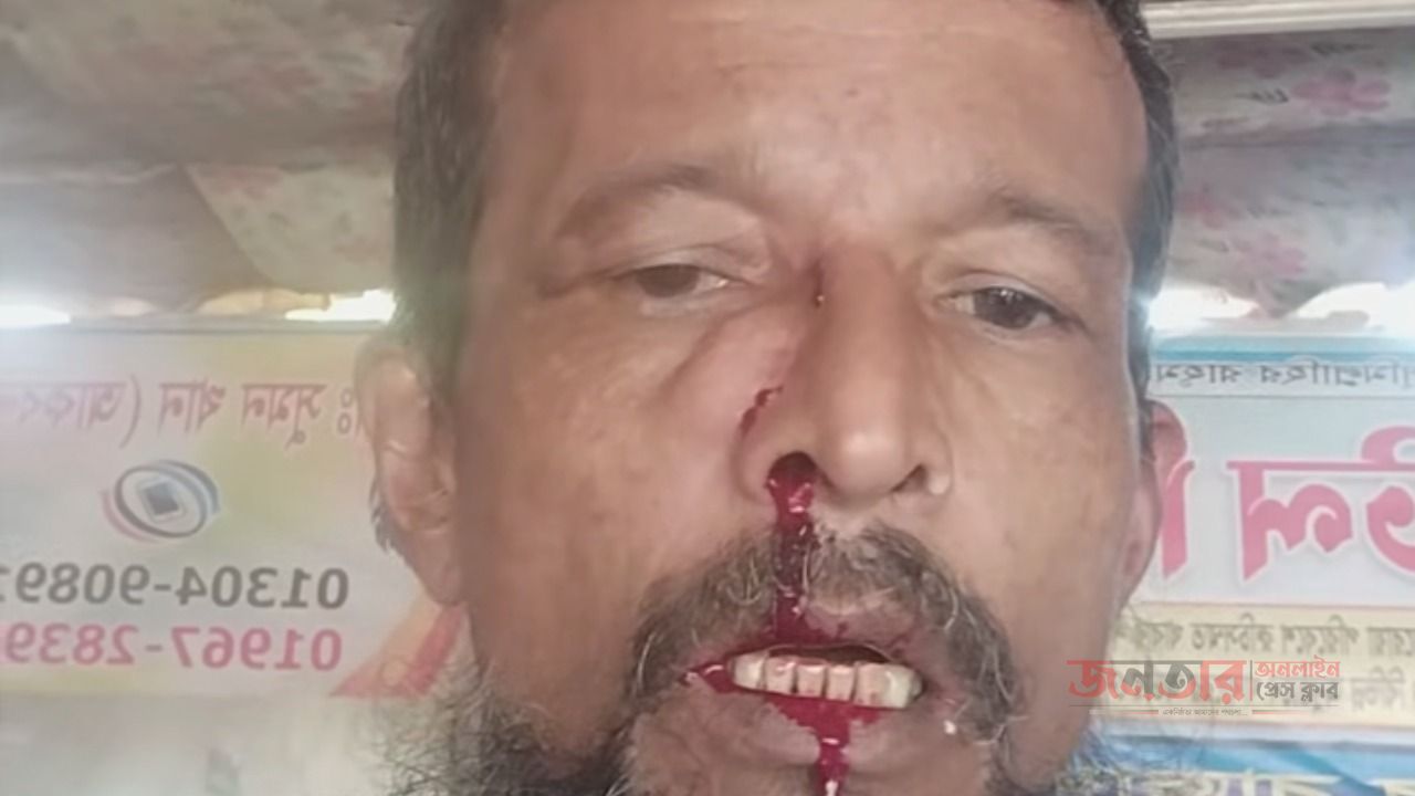 ​সাধারণ নাগরিকের ওপর নৃশংস হামলা: প্রাণে বাঁচলেন ভুক্তভোগী