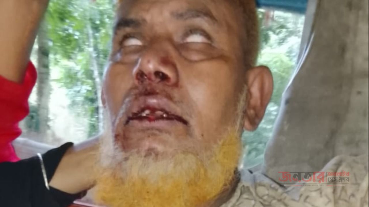 মাদারীপুরে ছোট ভাইয়ের আঘাতে বড় ভাই রক্তাক্ত 